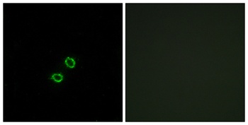 CD158f2 rabbit pAb Antibody