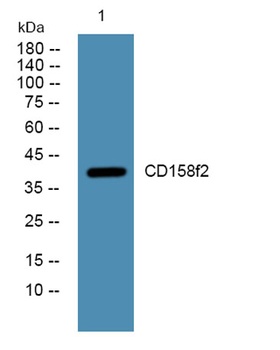 CD158f2 rabbit pAb Antibody