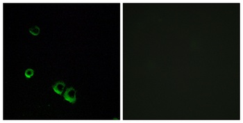 AVP Receptor V2 rabbit pAb Antibody