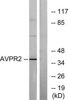 AVP Receptor V2 rabbit pAb Antibody