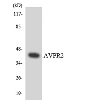 AVP Receptor V2 rabbit pAb Antibody