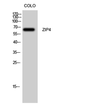 ZIP4 rabbit pAb Antibody