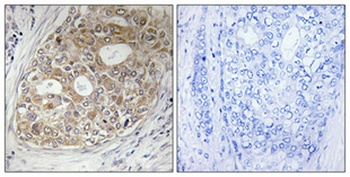 ARF GAP1 rabbit pAb Antibody