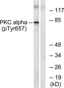 PKC α (phospho Tyr658) rabbit pAb Antibody