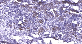 PKC α (phospho Tyr658) rabbit pAb Antibody