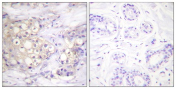 PKC α (phospho Thr638) rabbit pAb Antibody