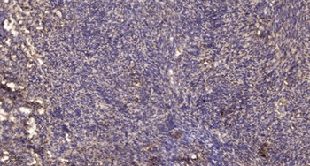 PKC δ (phospho Tyr64) rabbit pAb Antibody