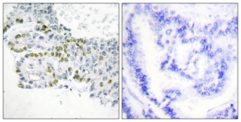 PKC δ (phospho Tyr52) rabbit pAb Antibody