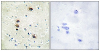 PKD1 (phospho Ser205) rabbit pAb Antibody