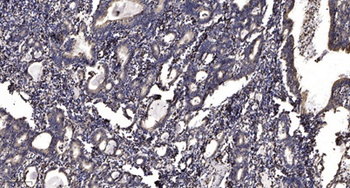 PKD1/2/3 rabbit pAb Antibody