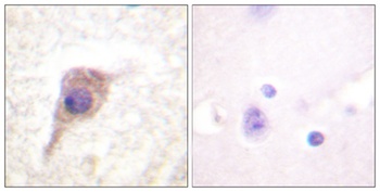 PKC ζ (phospho Thr560) rabbit pAb Antibody