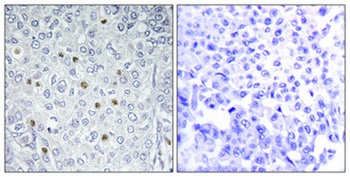 ERK 3 rabbit pAb Antibody