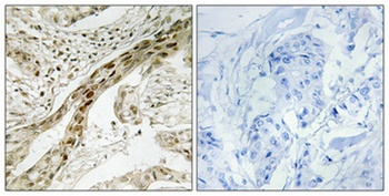 MEK-1 (phospho Thr292) rabbit pAb Antibody