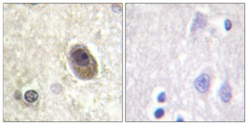 Bad (phospho Ser134) rabbit pAb Antibody