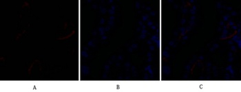 Bad rabbit pAb Antibody