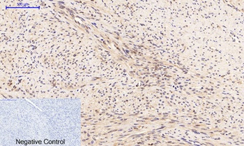 PTEN (phospho Ser380/T382/T383) rabbit pAb Antibody