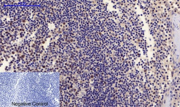 PTEN (phospho Ser380/T382/T383) rabbit pAb Antibody