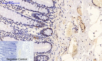 PTEN (phospho Ser380/T382/T383) rabbit pAb Antibody