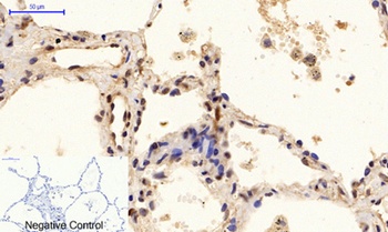 PTEN (phospho Ser380/T382/T383) rabbit pAb Antibody