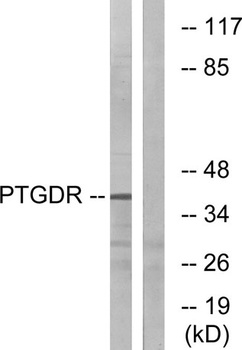 PD2R rabbit pAb Antibody