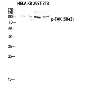 FAK (phospho Ser843) rabbit pAb Antibody
