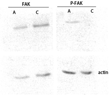 FAK (phospho Ser843) rabbit pAb Antibody