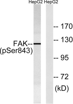 FAK (phospho Ser843) rabbit pAb Antibody