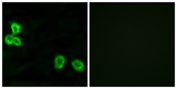 BAI-1 rabbit pAb Antibody