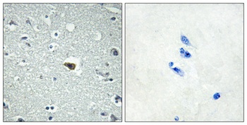 BAI-1 rabbit pAb Antibody