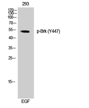 Brk (phospho Tyr447) rabbit pAb Antibody