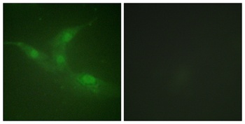 Brk (phospho Tyr447) rabbit pAb Antibody