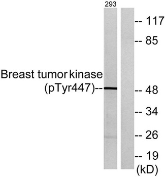 Brk (phospho Tyr447) rabbit pAb Antibody