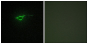 COL20A1 rabbit pAb Antibody