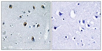 COL20A1 rabbit pAb Antibody