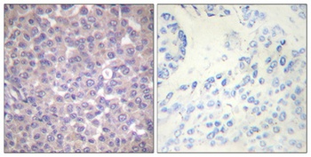 SH-PTP1 (phospho Tyr536) rabbit pAb Antibody