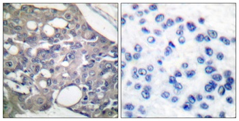 SH-PTP1 (phospho Tyr536) rabbit pAb Antibody
