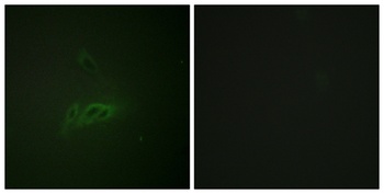 CD45 (phospho Ser1007) rabbit pAb Antibody