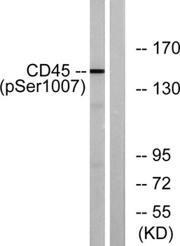 CD45 (phospho Ser1007) rabbit pAb Antibody