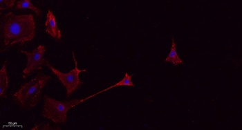 CD45 rabbit pAb Antibody