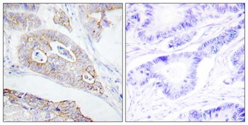 CD45 rabbit pAb Antibody