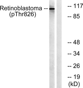 Rb (phospho Thr826) rabbit pAb Antibody