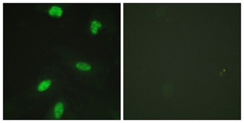 Rb (phospho Thr821) rabbit pAb Antibody