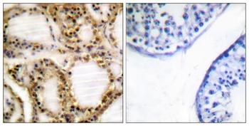 Rb (phospho Thr821) rabbit pAb Antibody