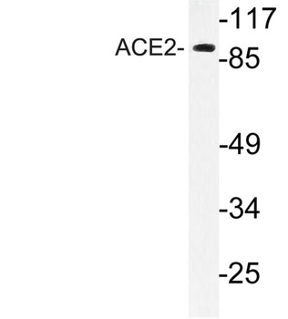 ACE2 rabbit pAb Antibody