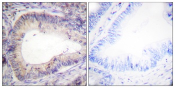 Bcl-2 (phospho Thr69) rabbit pAb Antibody