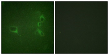 Bcr (phospho Tyr360) rabbit pAb Antibody