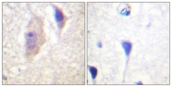 Bcr (phospho Tyr360) rabbit pAb Antibody