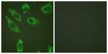Ribosomal Protein S6 (phospho Ser240) rabbit pAb Antibody