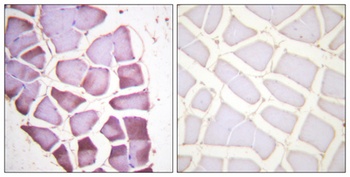Ribosomal Protein S6 (phospho Ser240) rabbit pAb Antibody