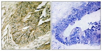 Rsk-1 (phospho Ser380) rabbit pAb Antibody